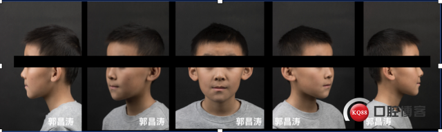 河源市淘汰一批落后设备:开云即时比分(图3) 开云体育官网